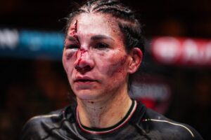 Read more about the article Former title challenger suffers ‘worst cut in UFC history’ in bloody battle on UFC 306 undercard