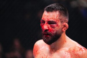 Read more about the article UFC Paris main event stopped early due to gruesome injuries that could retire French fighter