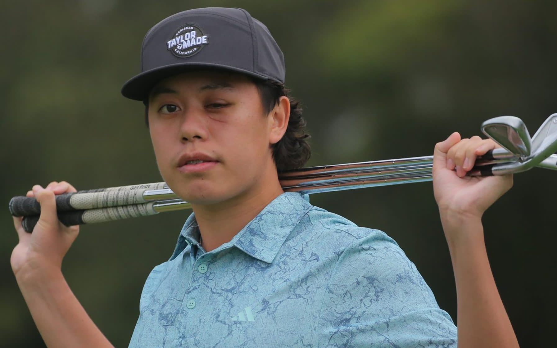 You are currently viewing Rising golf star Jeffrey Guan loses sight in one eye after being hit by ball in pro-am