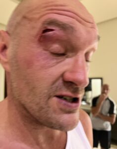 Read more about the article Tyson Fury ‘didn’t spar’ before Oleksandr Usyk defeat over injury fears as coach explains why rematch will be different