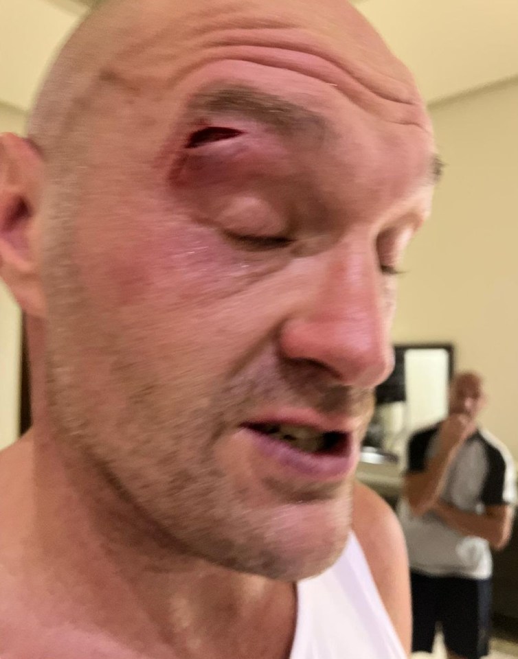 You are currently viewing Tyson Fury ‘didn’t spar’ before Oleksandr Usyk defeat over injury fears as coach explains why rematch will be different