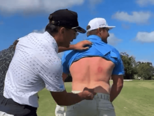 Read more about the article Bryson DeChambeau left with gruesome bruise after being hit with rock hard egg