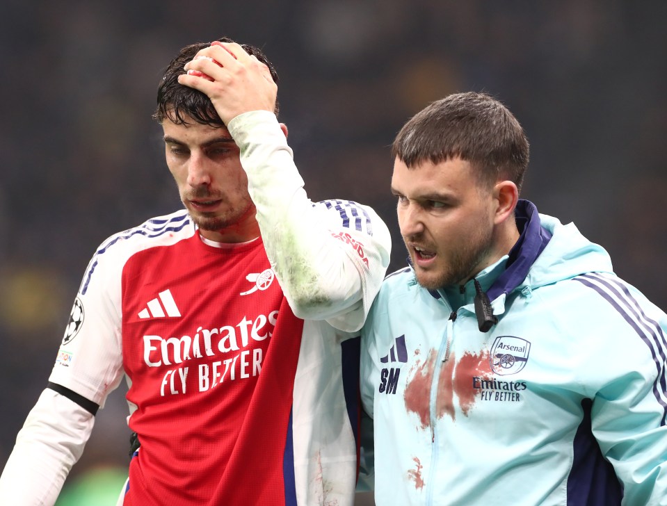 You are currently viewing Kai Havertz leaves pitch with blood pouring from head after nasty collision