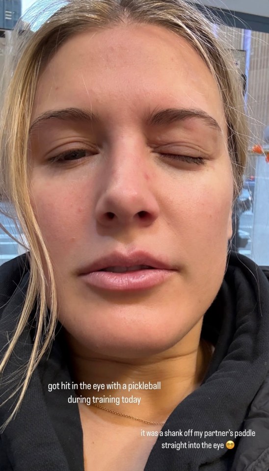 You are currently viewing Eugenie Bouchard shows off new look after freak pickleball injury sends her to hospital