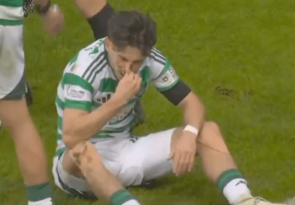 You are currently viewing Celtic star Nicolas Kuhn left bloodied in chaotic first half of Old Firm derby as manager is forced to intervene