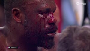 Read more about the article Derek Chisora survives horror cut to incredibly drop Otto Wallin twice and get fairytale ending on home soil