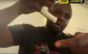 Read more about the article Dillian Whyte shows off gruesome injury as he delivers first update after withdrawing from Joe Joyce fight