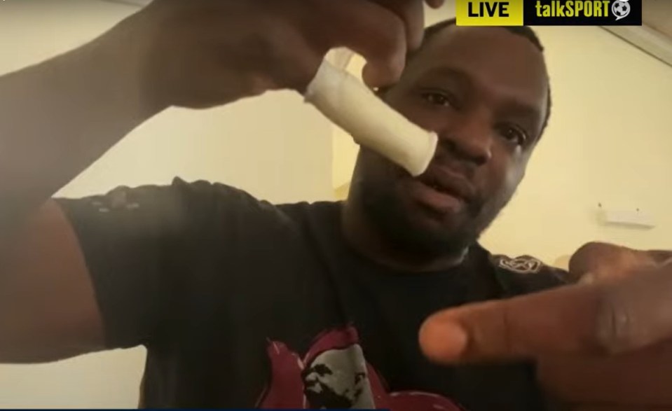 You are currently viewing Dillian Whyte shows off gruesome injury as he delivers first update after withdrawing from Joe Joyce fight