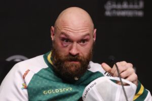 Read more about the article ‘I expect him to be back’ – Eddie Hearn explains why Anthony Joshua vs Tyson Fury is now easier to make