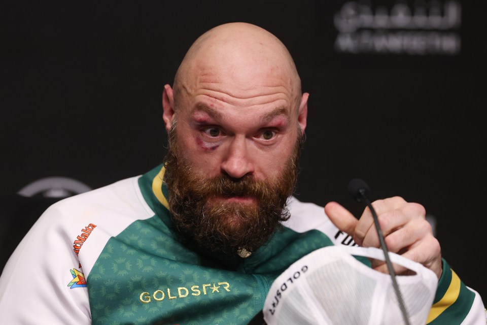 You are currently viewing ‘I expect him to be back’ – Eddie Hearn explains why Anthony Joshua vs Tyson Fury is now easier to make